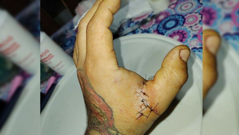 Atacó con un cuchillo al hombre que tatuó a su hija