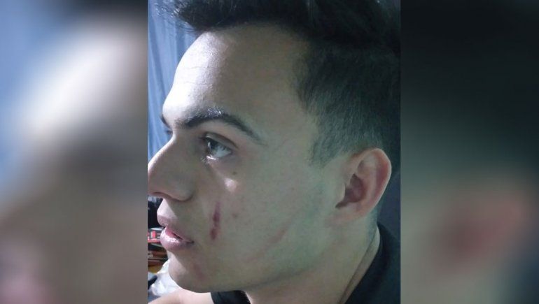 Escándalo: agreden a jueces de inferiores a termazos y a piñas