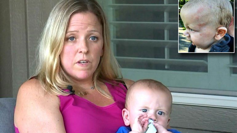 Un bebé sufrió hemorragia cerebral por una cachetada