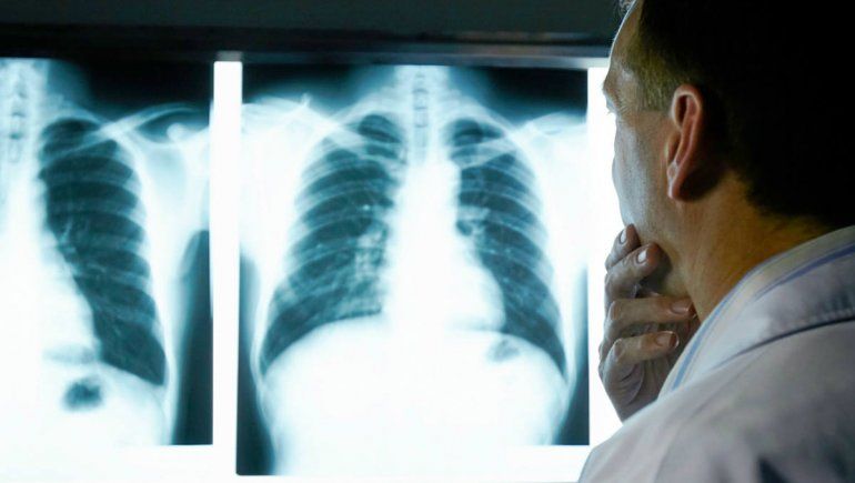 COVID: tras 150 días de recibir el alta, el 70% no se repuso del todo