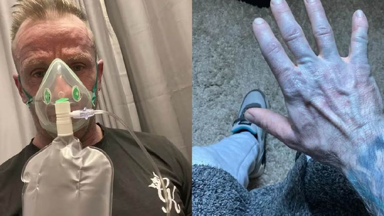 Tenía la piel azul l de pies a cabeza, al igual que los personajes de la pelicula Avatar de James Cameron. | LM Neuquen Tenía la piel azul l de pies a cabeza, al igual que los personajes de la pelicula Avatar de James Cameron.