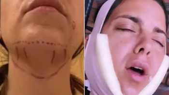 Belu Lucius decidió hacerse una operación en la cara. Belu Lucius decidió hacerse una operación en la cara.