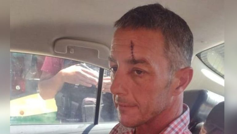 El hombre del botellazo se disculpó con el Presidente