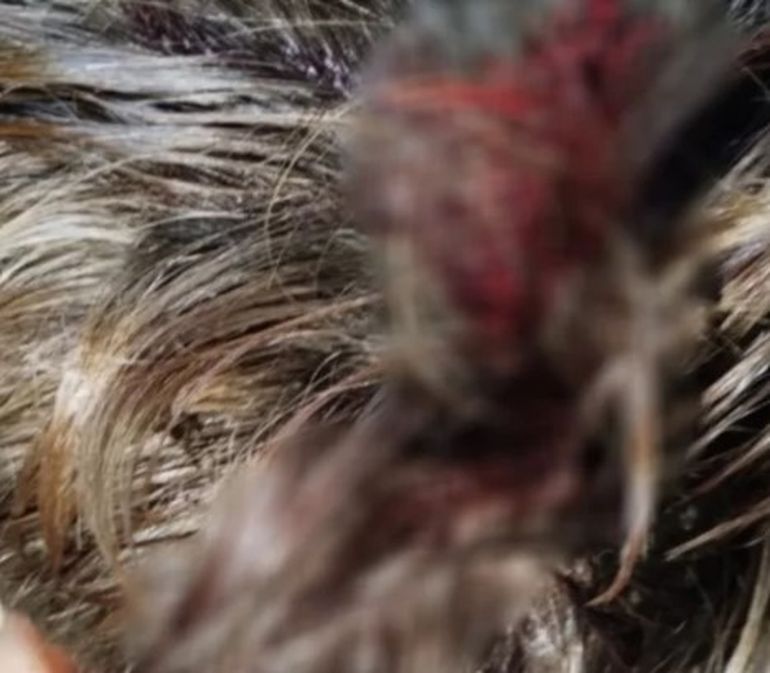 Trelew: el chico accidentado en la laguna Chiquichano sufrió una importante herida en la cabeza. Trelew: el chico accidentado en la laguna Chiquichano sufrió una importante herida en la cabeza.