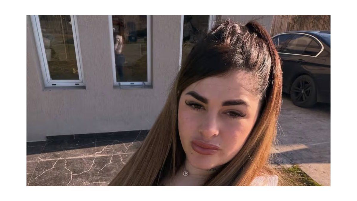 Influencer Kami Franco comparte su experiencia tras una cirugía estética