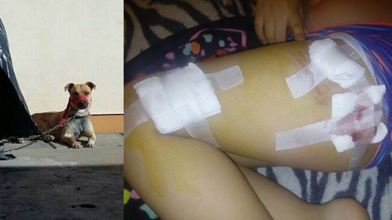 En menos de un mes, otro nene fue atacado por un perro en Zapala