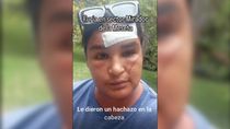 La mujer sufrió golpes y un hachazo en la cabeza. La mujer sufrió golpes y un hachazo en la cabeza.