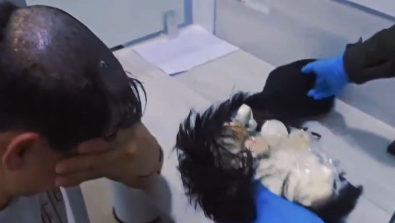 La cocaína que descubrieron debajo de la narcopeluca estaba fraccionada en 19 cápsulas y tenía una valuación de 10 mil euros.