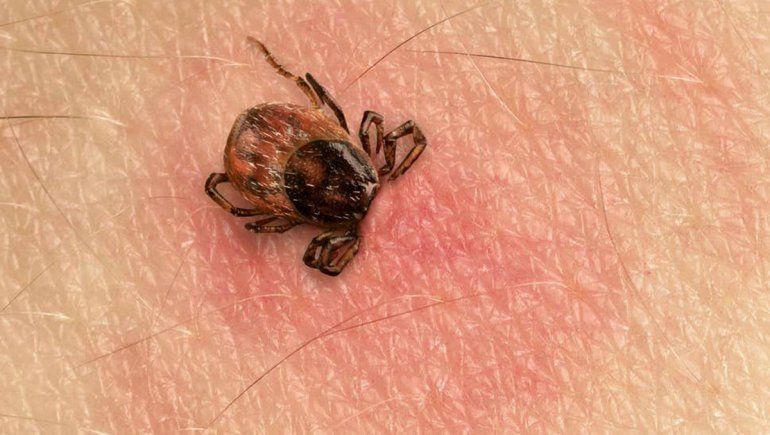 ¿Que es la enfermedad de Lyme que afecta a varios famosos?