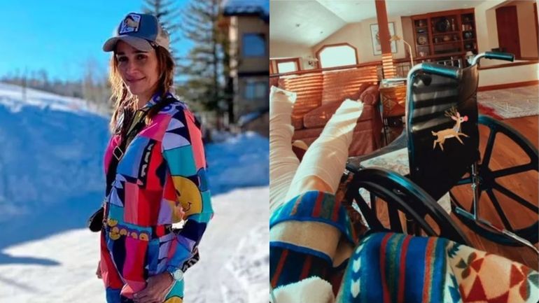 Impresionante: Vero Lozano mostró cómo le quedaron los pies tras la cirugía