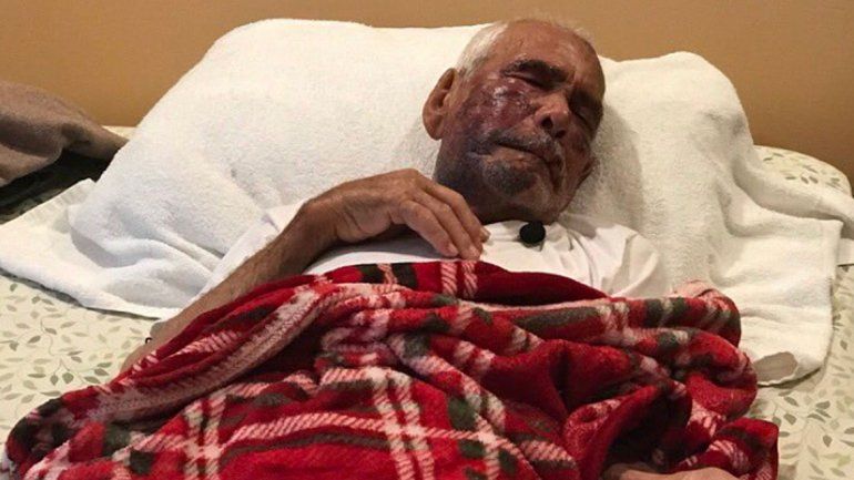 Una mujer le dio una brutal paliza a un anciano de 91