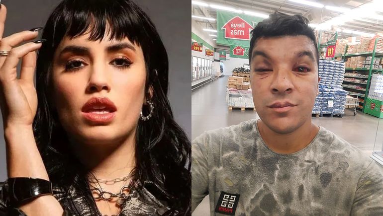 El tierno gesto de Lali con el joven que denunció un ataque homofóbico