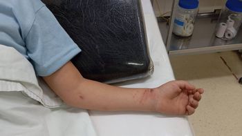 El nene debió ser internado. El nene debió ser internado.