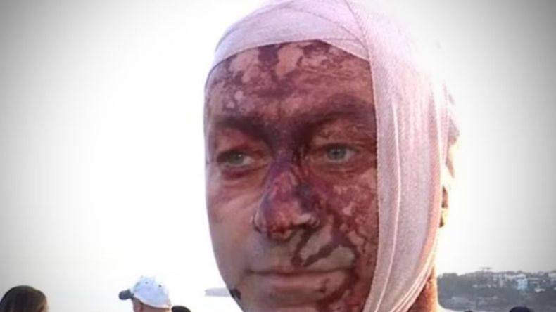 Sobrevivió al ataque de Hamas y ahora fue herido en un atentado antisemita en Australia | LM Neuquen Sobrevivió al ataque de Hamas y ahora fue herido en un atentado antisemita en Australia