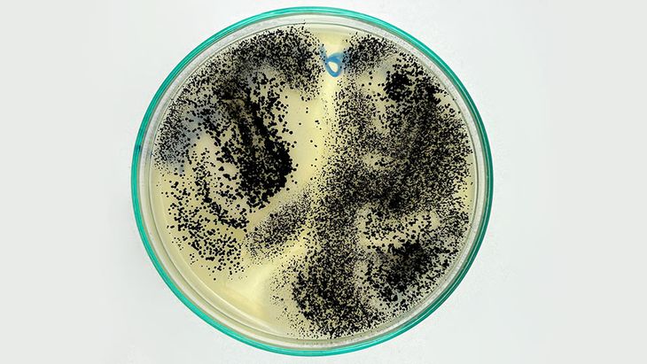 Hongo (Aspergillus sp) aislado de pasas de uva. Foto: gentileza Conicet Hongo (Aspergillus sp) aislado de pasas de uva. Foto: gentileza Conicet