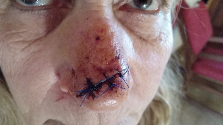 Brutal robo: la tajeó por todos lados con un cuchillo carnicero