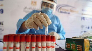 covid: el 90% de los argentinos tiene anticuerpos al mes covid: el 90% de los argentinos tiene anticuerpos al mes