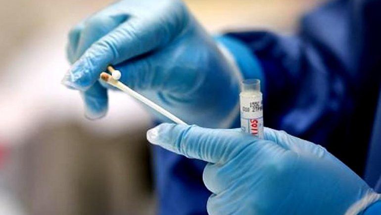 Coronavirus: se registraron 19 muertes y 1.581 nuevos casos