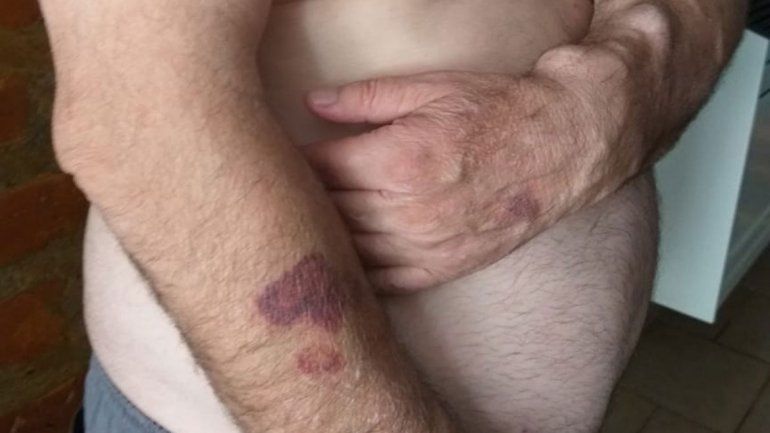 Violento asalto a un vecino en el basurero de Plottier