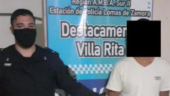 Golpeó-a-su-pareja-y-luego-le-quemó-el-rostro-con-una-plancha-2.jpg