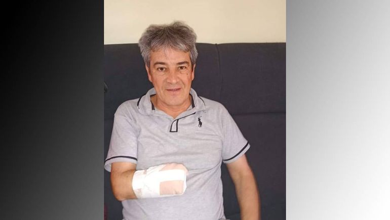 Un hombre perdió su mano y parte del brazo mientras trabajaba, y vende rifas para pagar su tratamiento