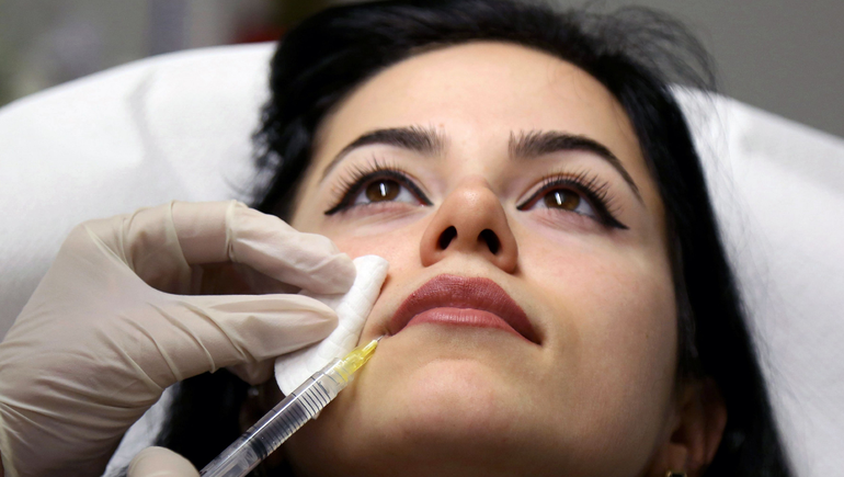 Cada vez más neuquinos usan ácido hialurónico: ¿moda o autoestima?