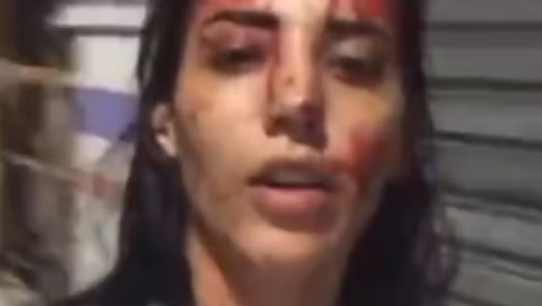 Una joven apuñaló a su pareja y se filmó ensangrentada.