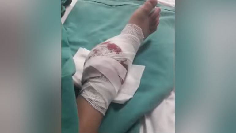 Una nena resultó herida cuando se le cayó encima la hamaca de una plaza