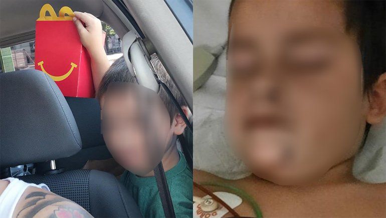 Nene cayó al sótano de una cafetería y se fracturó el cráneo