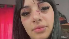 Las heridas en su rostro luego del ataque. | LM Neuquen Las heridas en su rostro luego del ataque.