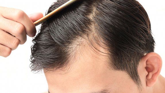Abre una nueva sucursal de Hair Recovery en Neuquén