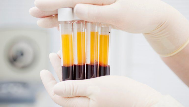Covid-19: ¿El plasma es realmente efectivo para tratar la enfermedad?