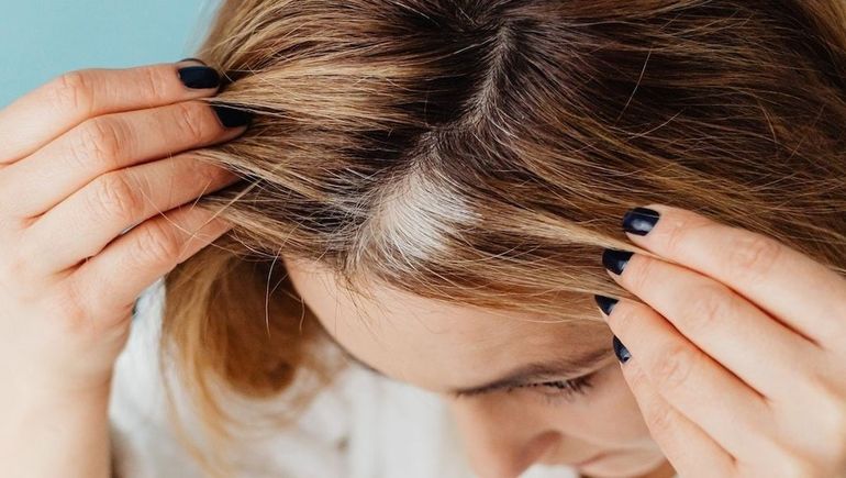 Un simple cuidado natural puede mejorar la apariencia de las canas y devolver brillo al cabello. Un simple cuidado natural puede mejorar la apariencia de las canas y devolver brillo al cabello.