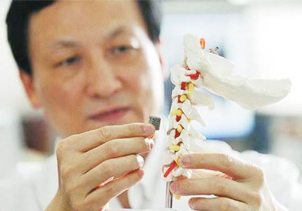 Imprimen vértebra en 3D y la implantan en un niño de 12 años