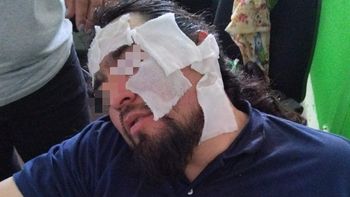 ataque gas pimienta ate neuquen.jpg