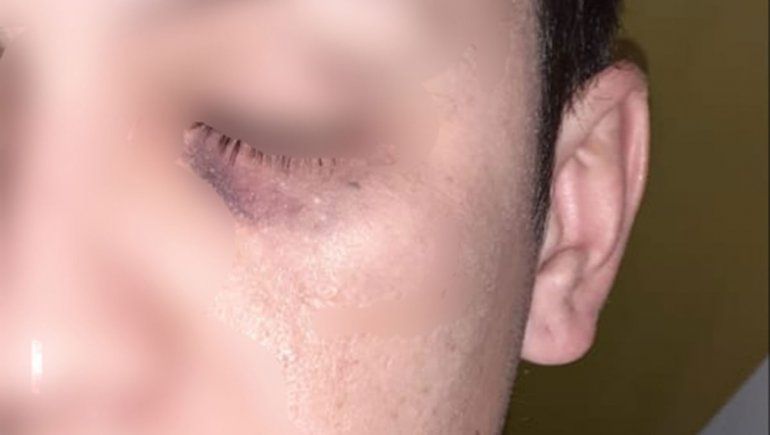 Cuatro denuncias de abuso policial en menos de 7 días