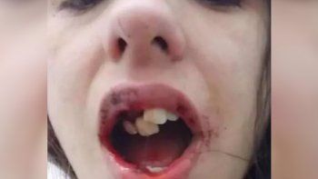 con la boca destrozada por sus golpes, corri a buscar a mi nena que estaba con el con la boca destrozada por sus golpes, corri a buscar a mi nena que estaba con el