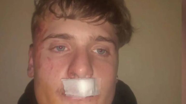 Joven de 19 años fue salvajemente golpeado por un grupo de rugbiers durante una fiesta en Zárate, provincia de Buenos Aires. Foto: Google. Joven de 19 años fue salvajemente golpeado por un grupo de rugbiers durante una fiesta en Zárate, provincia de Buenos Aires. Foto: Google.