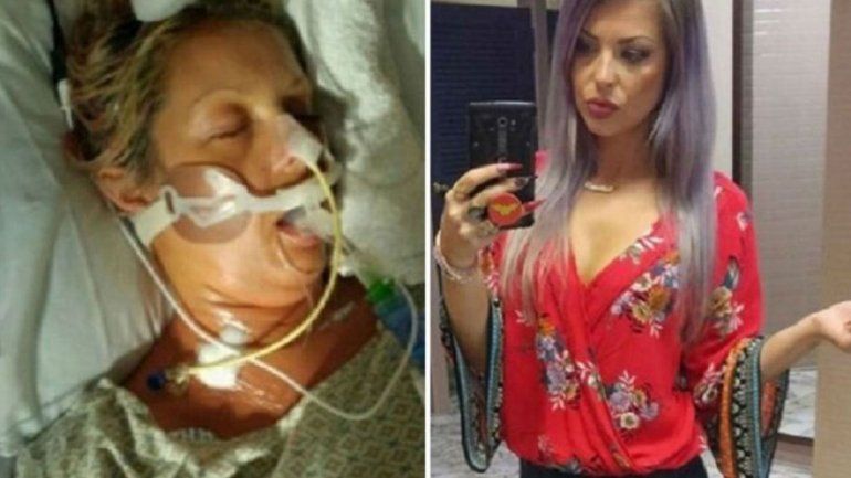 Creyó que era estrés y se estaba muriendo