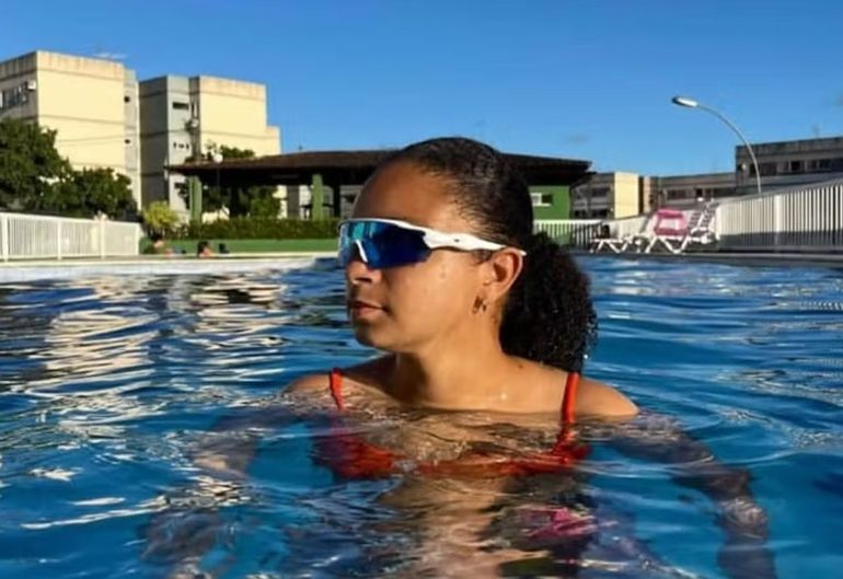A Marcela Vitória de Lima Santos, de 19 años, le amputaron una de sus piernas por la mordida del tiburón. A Marcela Vitória de Lima Santos, de 19 años, le amputaron una de sus piernas por la mordida del tiburón.