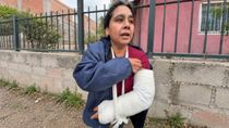 La mujer atacada por los dogos habló tras salir del hospital e hizo una fuerte acusación a los dueños.