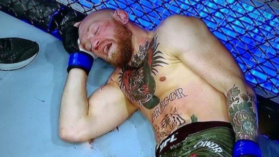 El drama de McGregor: varios meses inactivo tras la feroz paliza sufrida