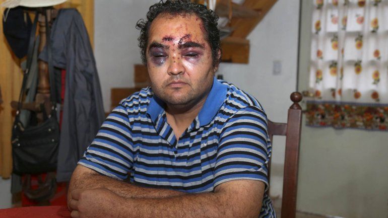 Juan Marcelo Garrido padece retraso madurativo. Quedó totalmente desfigurado tras la golpiza que le dieron en la plaza Soldado Ávila.