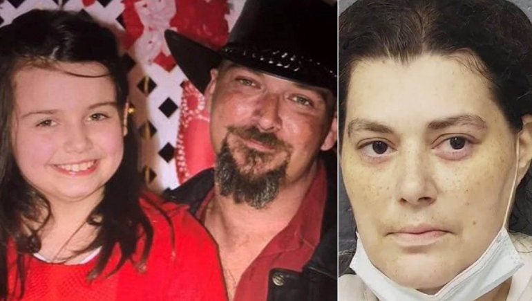 Espeluznante: una nena murió por una infestación de piojos y acusan a sus padres