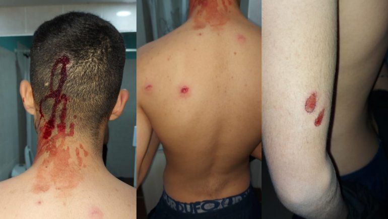 Denuncia que la Policía le disparó a su hijo en la puerta de su casa