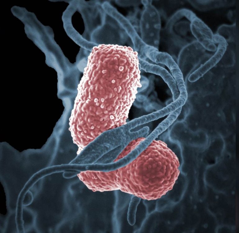 Alerta por bacteria resistente a todos los antibióticos