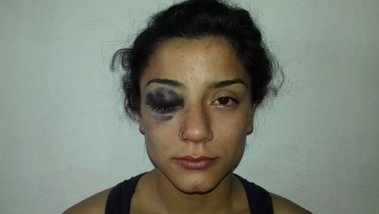 Una joven denunció que la golpearon policías de Plottier