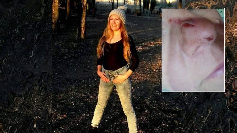 Mamá de una alumna atacó brutalmente a una profesora de danza: Me rompió la nariz