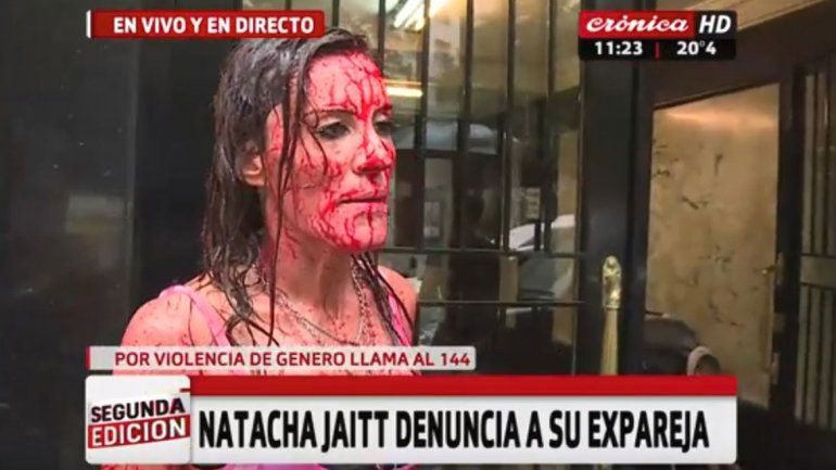Natacha Jaitt fue ensangrentada a denunciar a su ex ante la Justicia