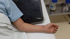 El nene debió ser internado. | LM Neuquen El nene debió ser internado.